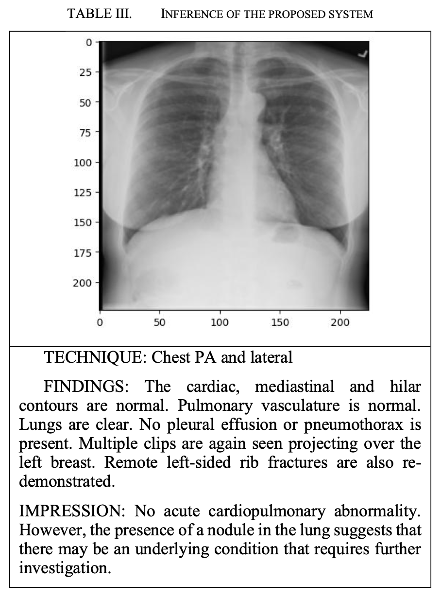 X-Ray Findings